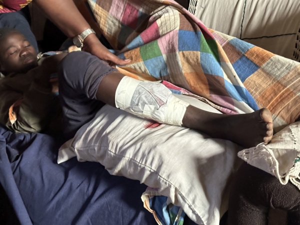 お兄ちゃんは、足を怪我して治療中<br class=sp_only>包帯や衛生環境がとても気になります